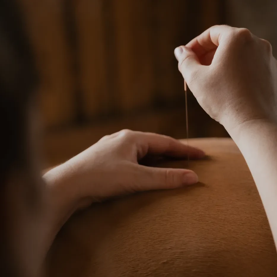 Dry Needling Behandlung am Pferd